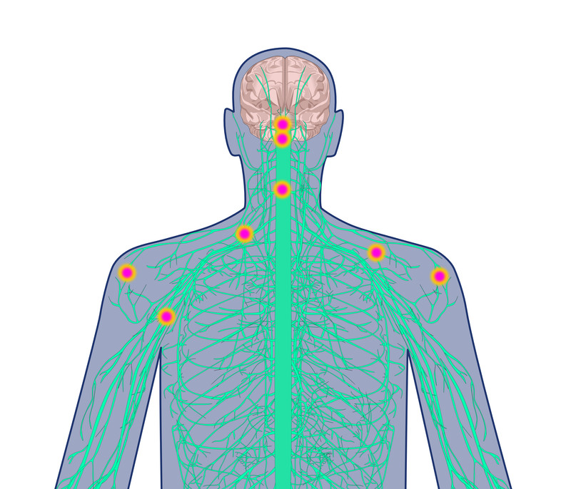 Schematic illustration of 'danger' signals being sent to the brain via the nervous system